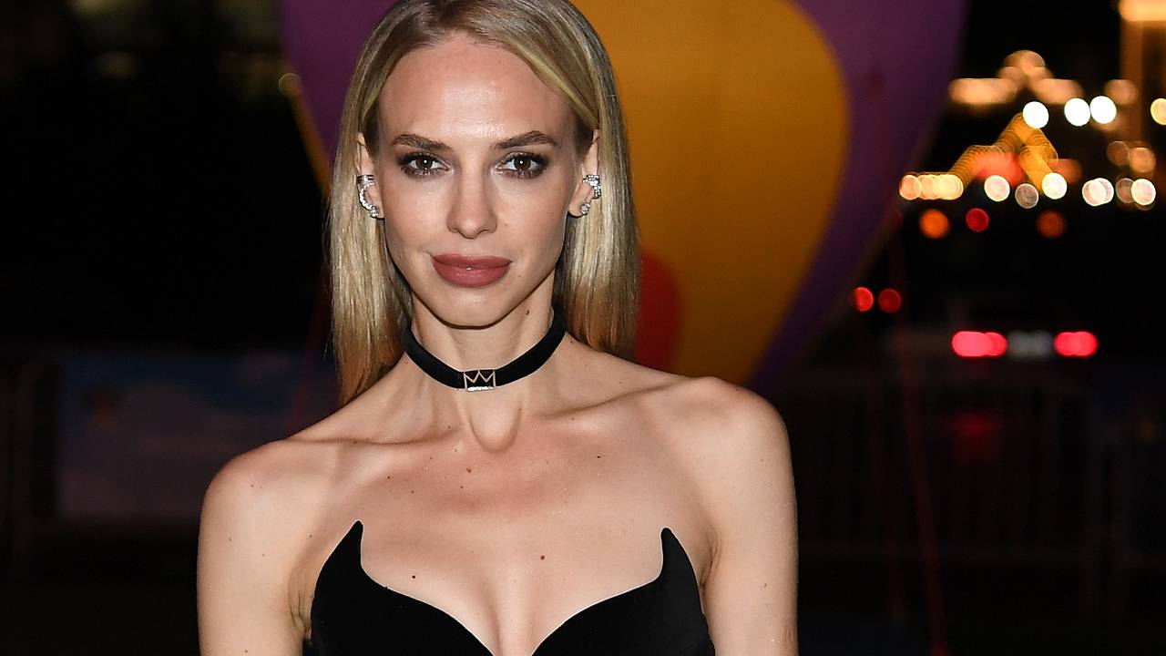 Звезда Comedy Woman призналась в желании сделать пластику после хейта в сети