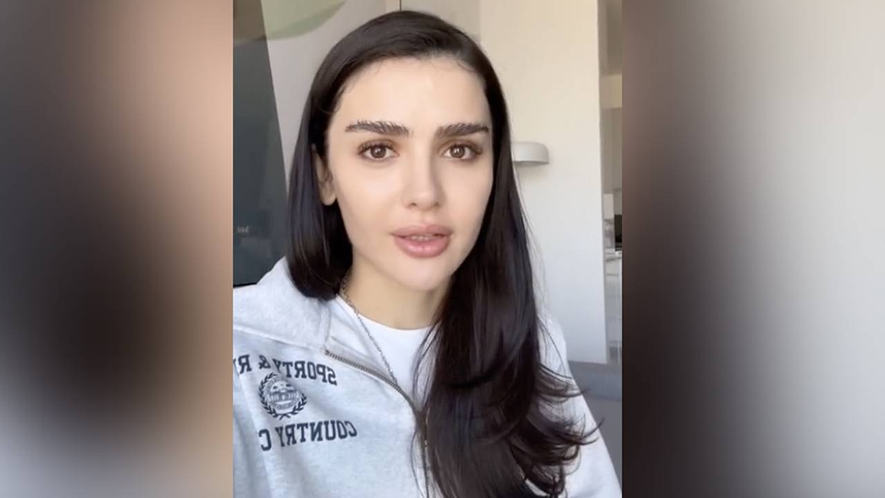 Дина Саева показала лицо без фильтров на фоне слухов о пластике