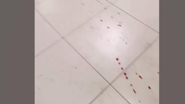 В Краснодаре завели дело после нападения школьника с ножом на сверстников