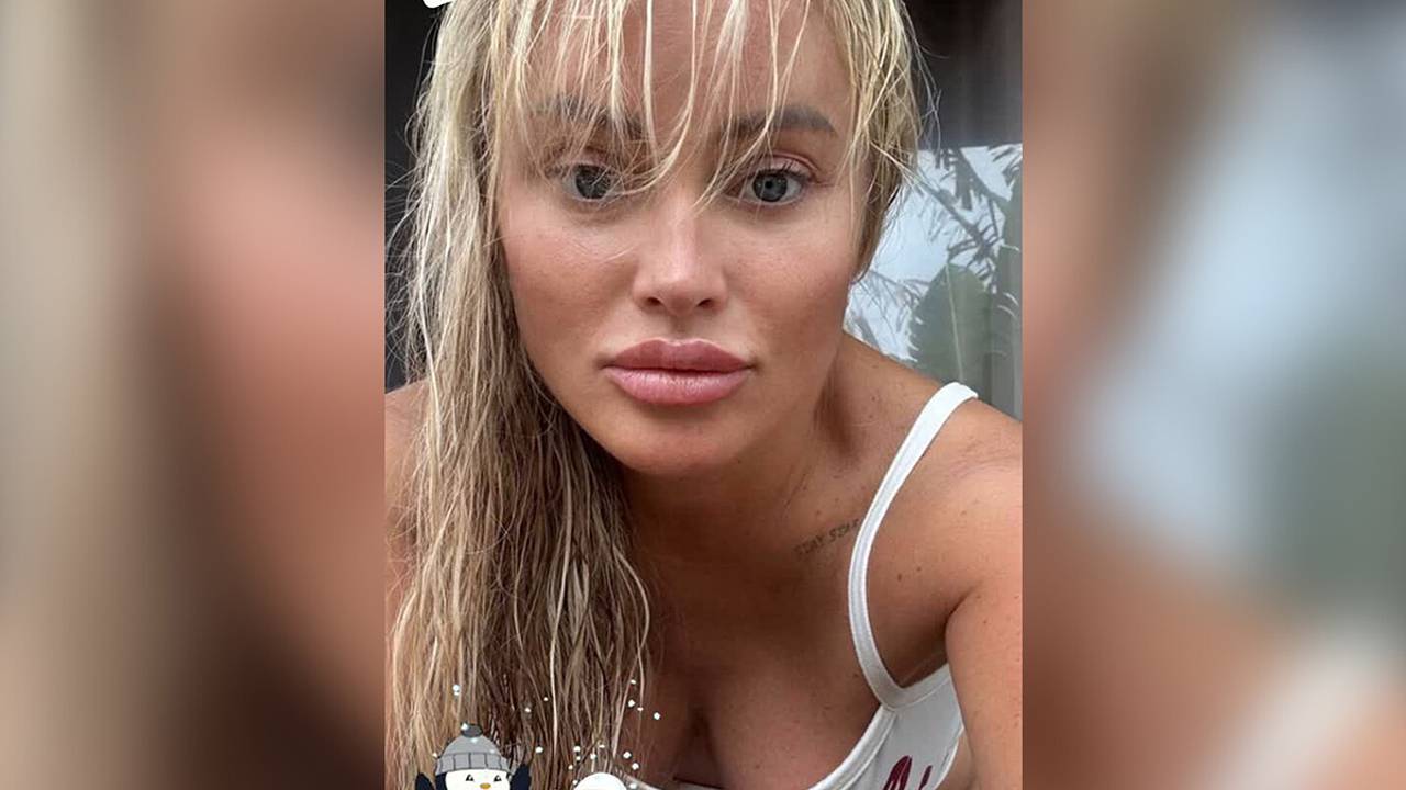 48-летняя Дана Борисова показала лицо спустя четыре месяца после пластики
