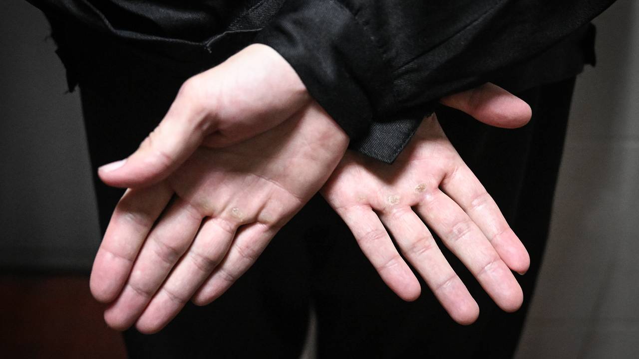 Украинский солдат сдался в плен из-за страха быть убитым сослуживцами