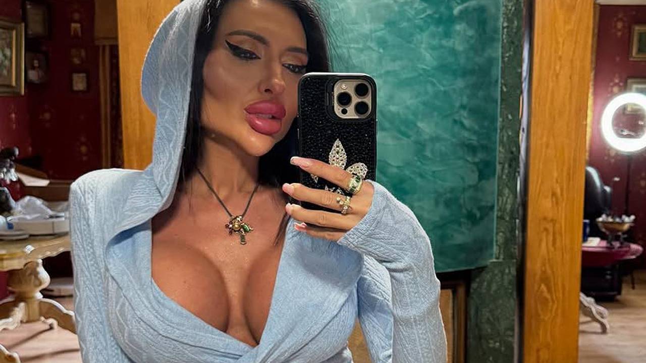 Украинка с самыми большими щеками в мире показала глубокое декольте на фото