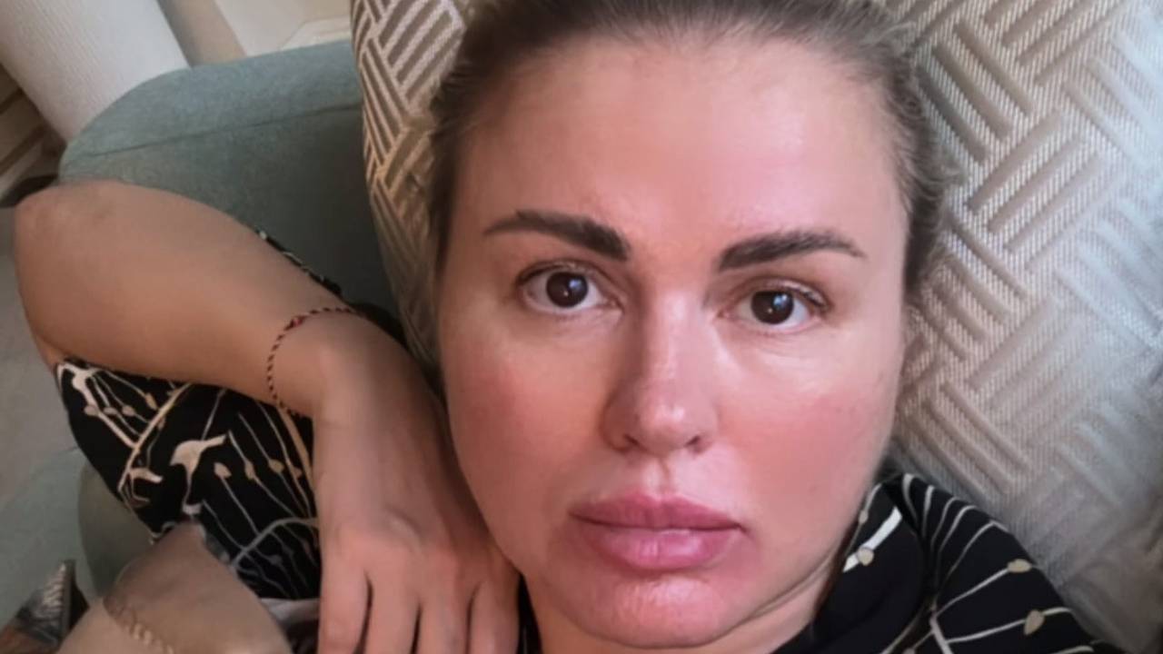 Анна Семенович во время болезни показала лицо без макияжа